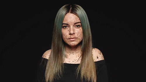 Portrait of a woman with freckles on body