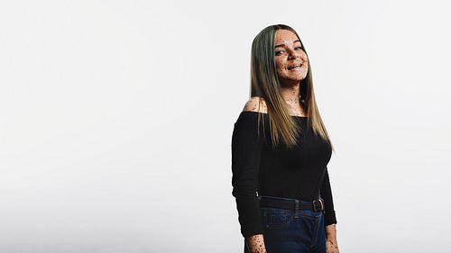 Woman with freckles on body