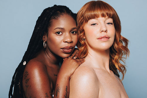 Two young women with different skin tones looking at the camera while standing together