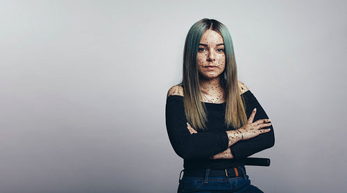 Woman with freckles on body