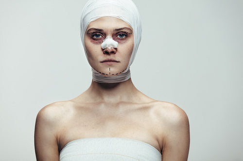 Woman after face lift surgery