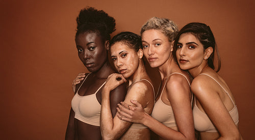Young women with different skin types