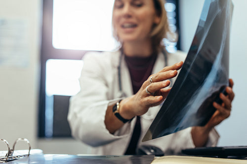 Doctor with x-ray discussing diagnosis