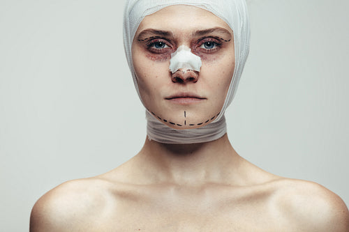 Woman after facial cosmetic surgery