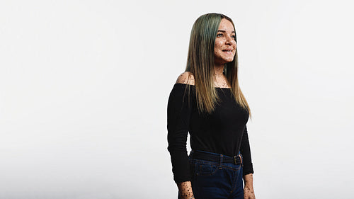 Woman with freckles on body