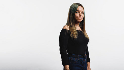 Portrait of a woman with freckles on body