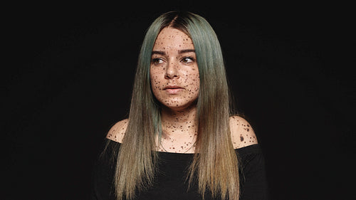 Portrait of a woman with freckles on body