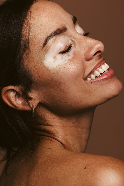 Smiling is the best way to embrace your flaws