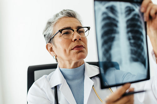 Careful examination: Doctor looks at an x-ray scan of the lungs
