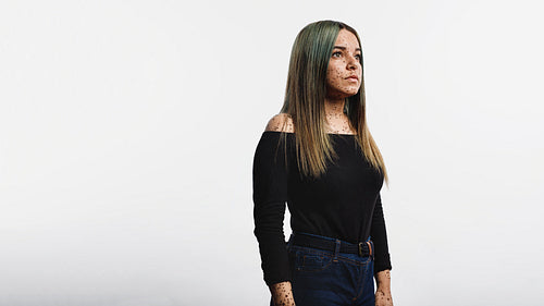 Woman with freckles on body