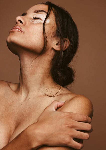 My skin is beautiful