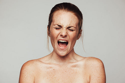 Frustration with with skin