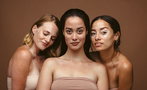 Woman embracing their imperfections