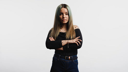 Woman with freckles on body