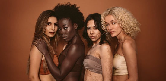 Beautiful women with various skin types stock photo (139343) -  YouWorkForThem